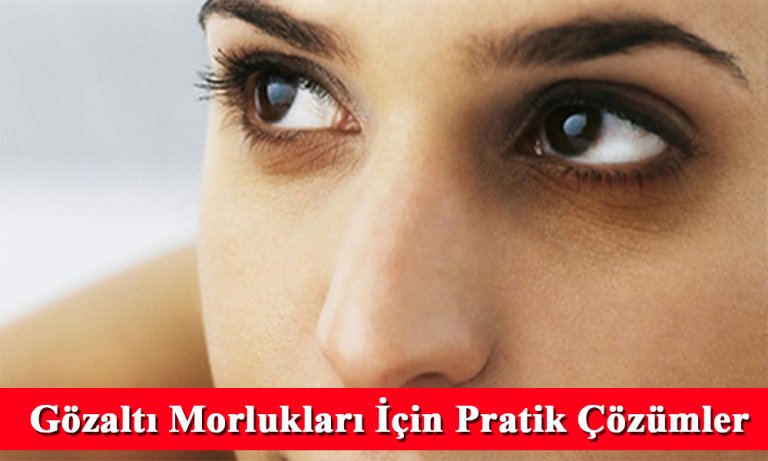 Gözaltı morlukları için elinizin altındaki malzemelerle pratik çözüm önerileri!