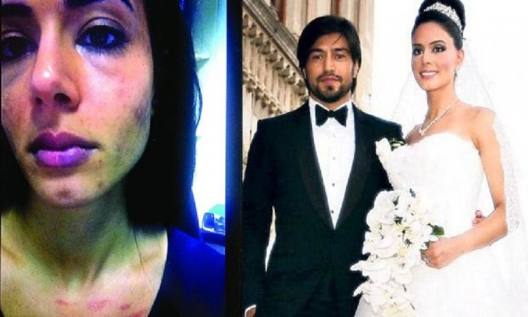 Eylem Toraman: “Kocam İbrahim Toraman’ı en yakın arkadaşımla yakaladım!”