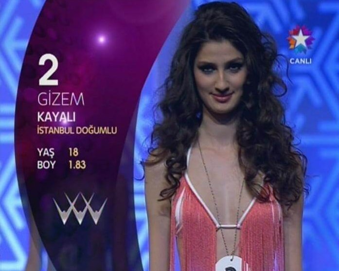 Best Model Of Turkey 2016 Birincisi Gizem Kayalı Burnunu Yaptırdı