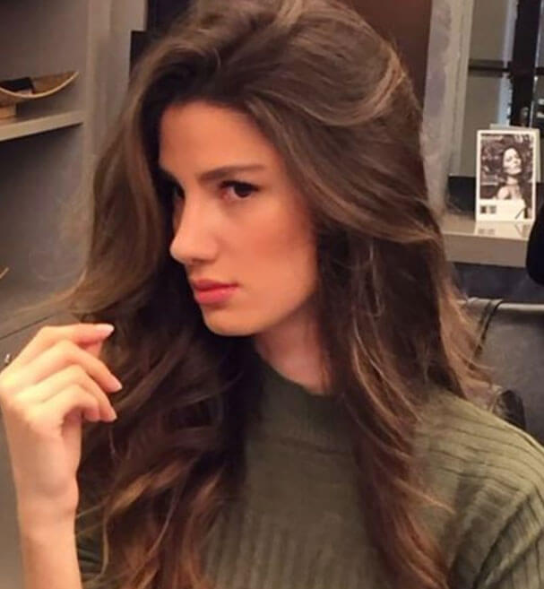 Best Model Of Turkey 2016 Birincisi Gizem Kayalı Burnunu Yaptırdı
