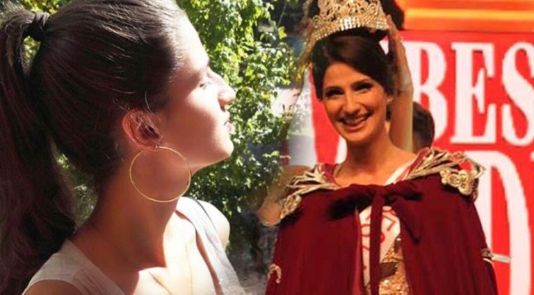 Best Model Of Turkey 2016 Birincisi Gizem Kayalı Burnunu Yaptırdı