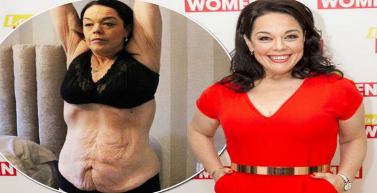 Lisa Riley Zayıflamasını Gözyaşları İçinde Anlattı: Etleri İç Çamaşırıma Sıkıştırıyordum