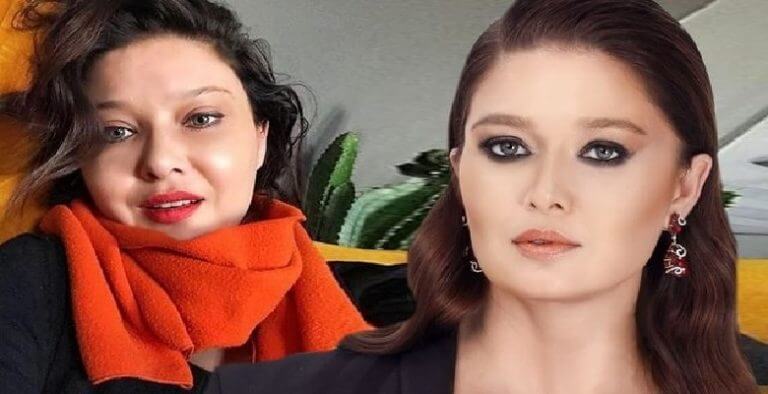 Botokstan pişman olan Nurgül Yeşilçay, estetik merkezi çıkışı görüntülendi!
