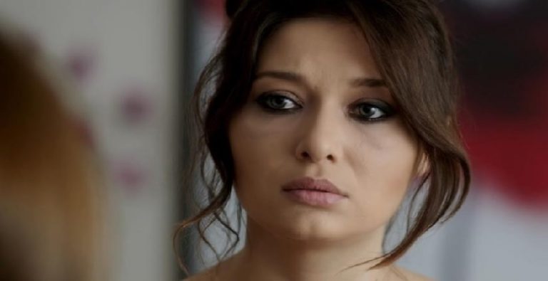 Botoks kurbanı Nurgül Yeşilçay’ın yeni trendi köpekbalığı…