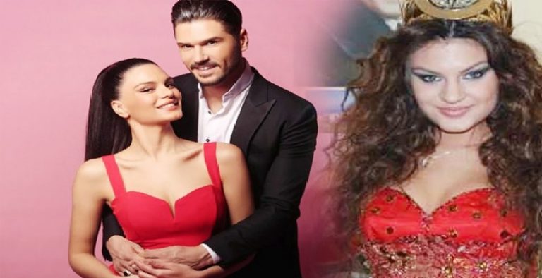 Tolgahan Sayışman, eşinin estetik yaptırmasını eleştirenlere isyan etti!