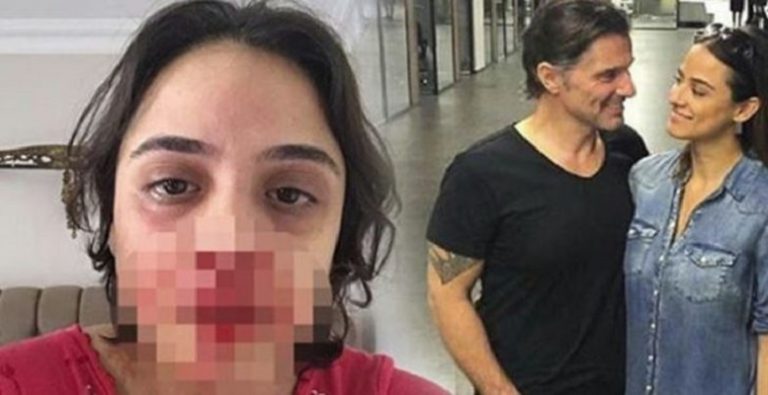 Nişanlısına şiddet uygulayan Hazım Körmükçü’den ‘özür’ açıklaması