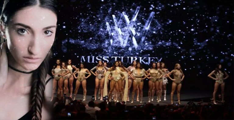 Miss Turkey 2018 birincisinin estetiksiz halleri!