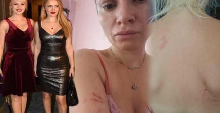 Seçkin Piriler, dayak yediği Meral Kaplan’ı affetti mi?