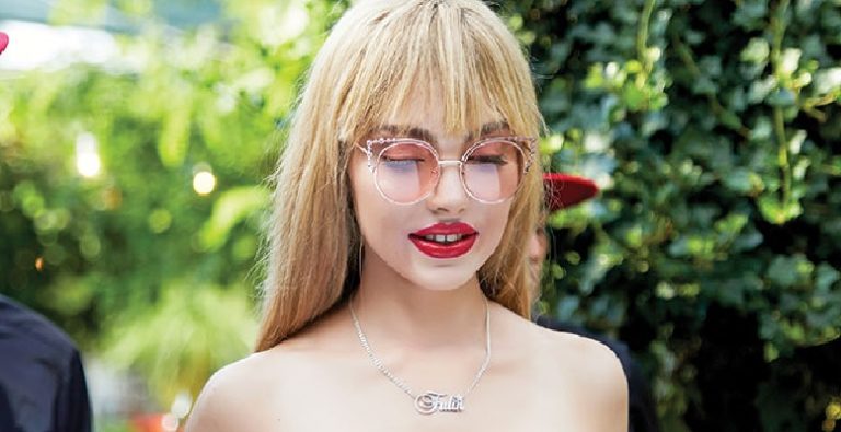 Fulin yandı! 2. derece yanık olan Fulin çok acı çekiyor!