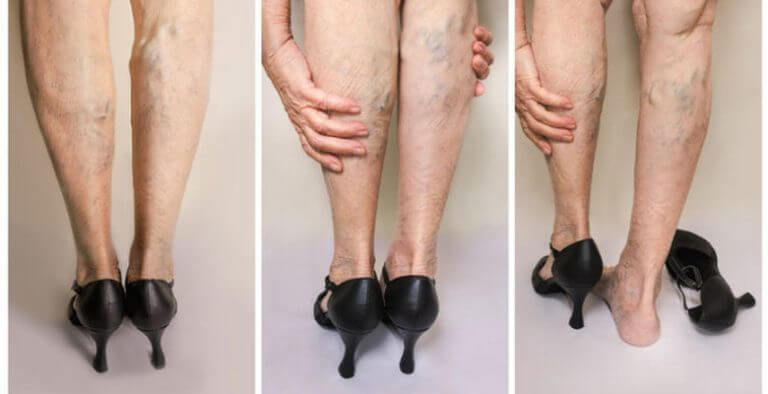 Varisi olan kadınlar haberimize göz atsın!