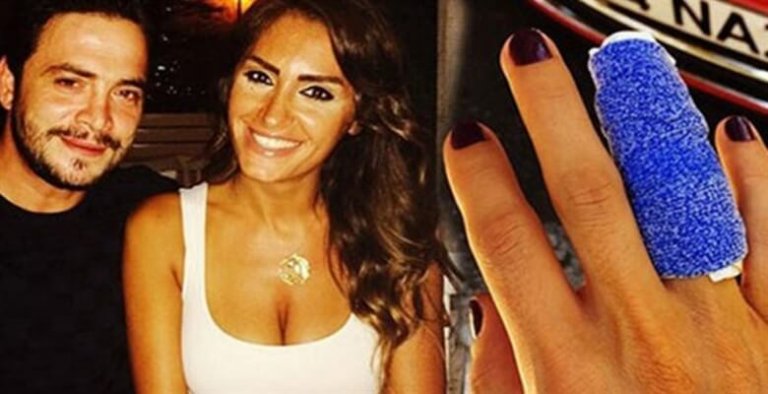 Gülerek parmağını kırdı!