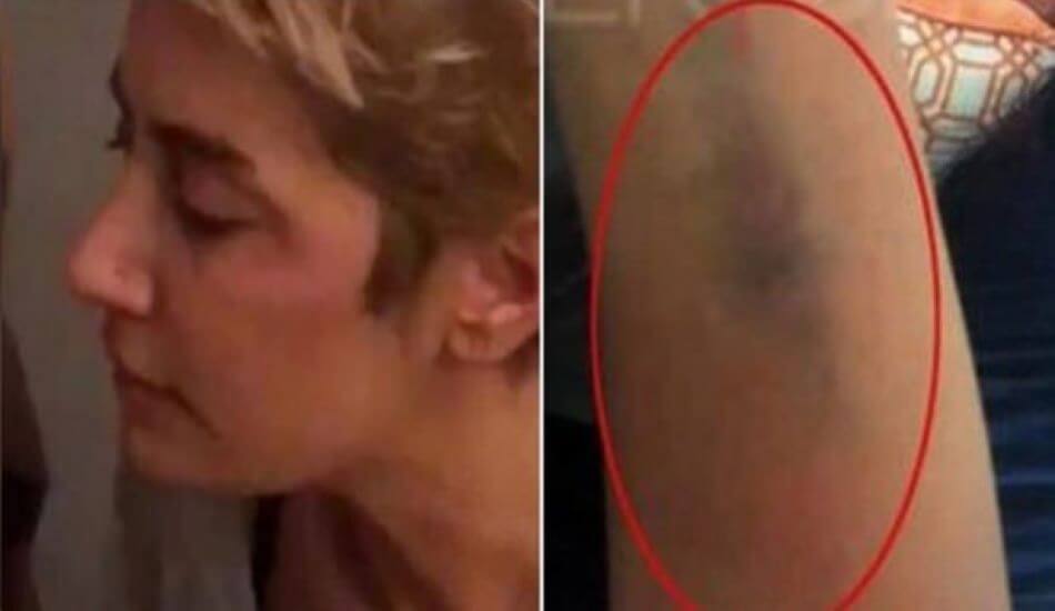 sila-kollarindaki-darp-morluklari