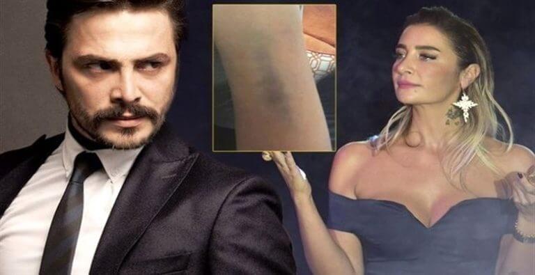 Sıla Darp Konusu Hakkında İlk Defa Konuştu!