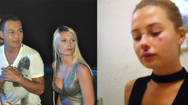 Serdar Ortaç'ın eşi Chloe Loughnan'ın darp edildiği iddia edildi