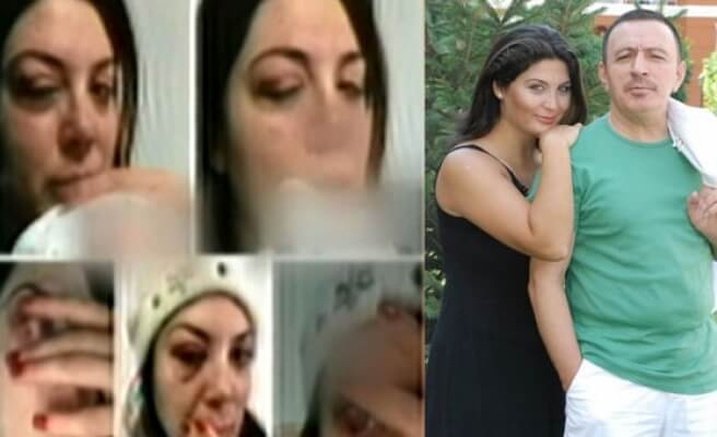 Mustafa Topaloğlu, eşine kasıtlı vurmadığını iddia etti