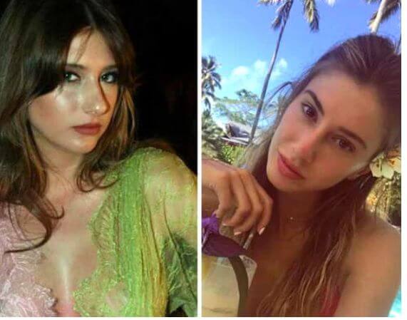 Şeyma Subaşı, yaptırdığı estetiklerle en çok konuşulan isimlerin başında geliyor