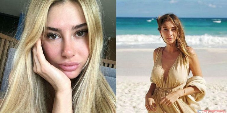 Şeyma Subaşı Badem Gözlü Olacağım Derken!