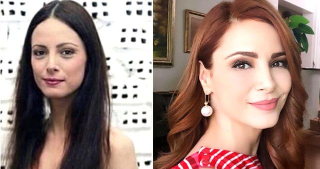 mine-tugay-estetiksiz