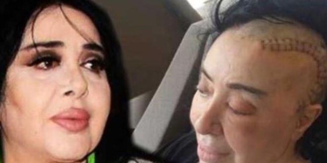 Nur Yerlitaş'ın Vasiyeti Belli Oldu Nur Yerlitaş Nereye Gömülecek