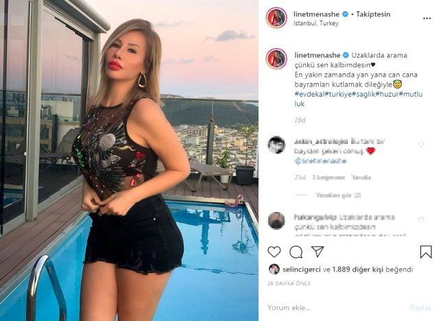 kalça büyütme estetiği yaptıran Linet