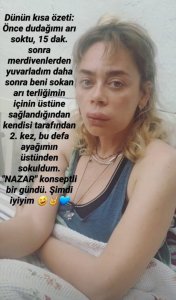 Demet Evgar’ın Dudağına Botoks mu Yaptırdı?
