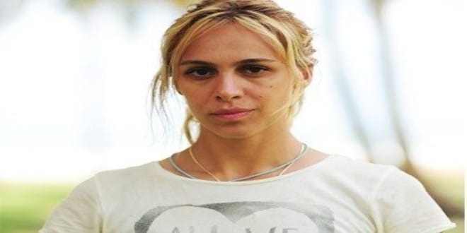 Survıvor Duygu Bal Estetikle Bambaşka Biri Oldu