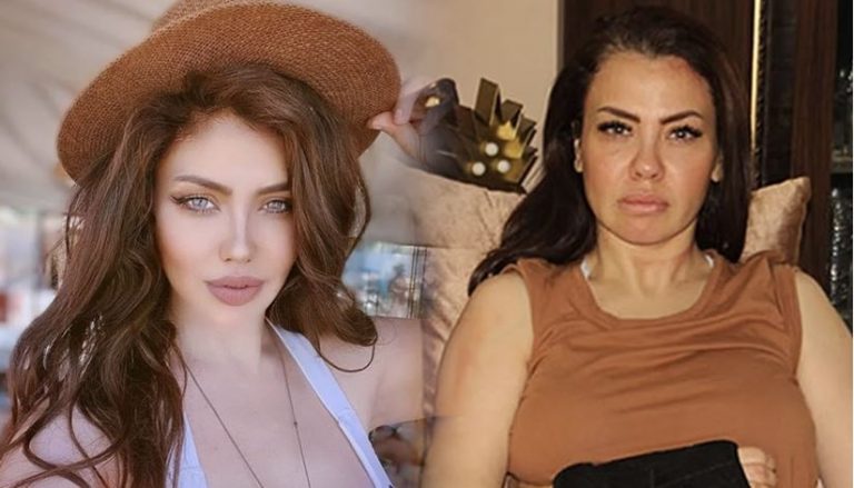 Dudaklarını Küçülttüren Lara Ağlayarak İsyan Etti