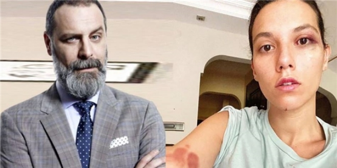 Darp Davası Devam Eden Ozan Güven İstanbul'dan Taşındı Mı?