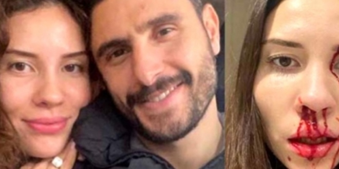 Futbolcu Özer Hurmacı 'nın Eşinden Olay Sözler!...