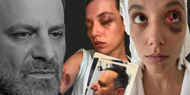 Ozan Güven'in Şoföründen Şiddet Günüyle Alakalı Çarpıcı Açıklamalar