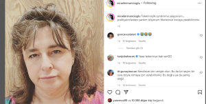 Esra Dermancıoğlu 'nun Tükenmişlik Sendromu Paylaşımı.