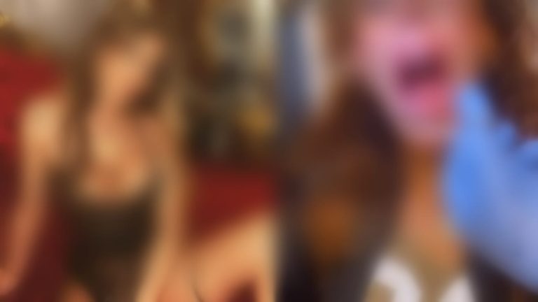 Ünlü sanatçının öpüşürken dili koptu!