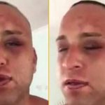 survivor taner komalık oldu