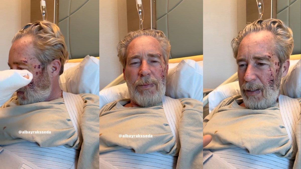 Oyuncu Sinan Albayrak dizi setinde kaza geçirdi!