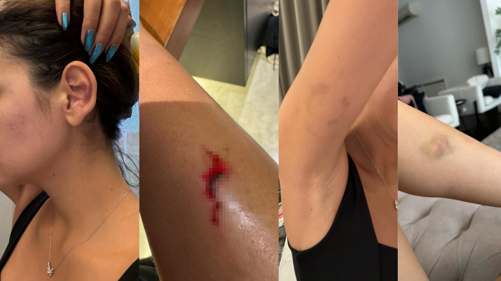 Fenomen Merve Taşkın’dan Şok İddialar: “Cinsel Organımı…”