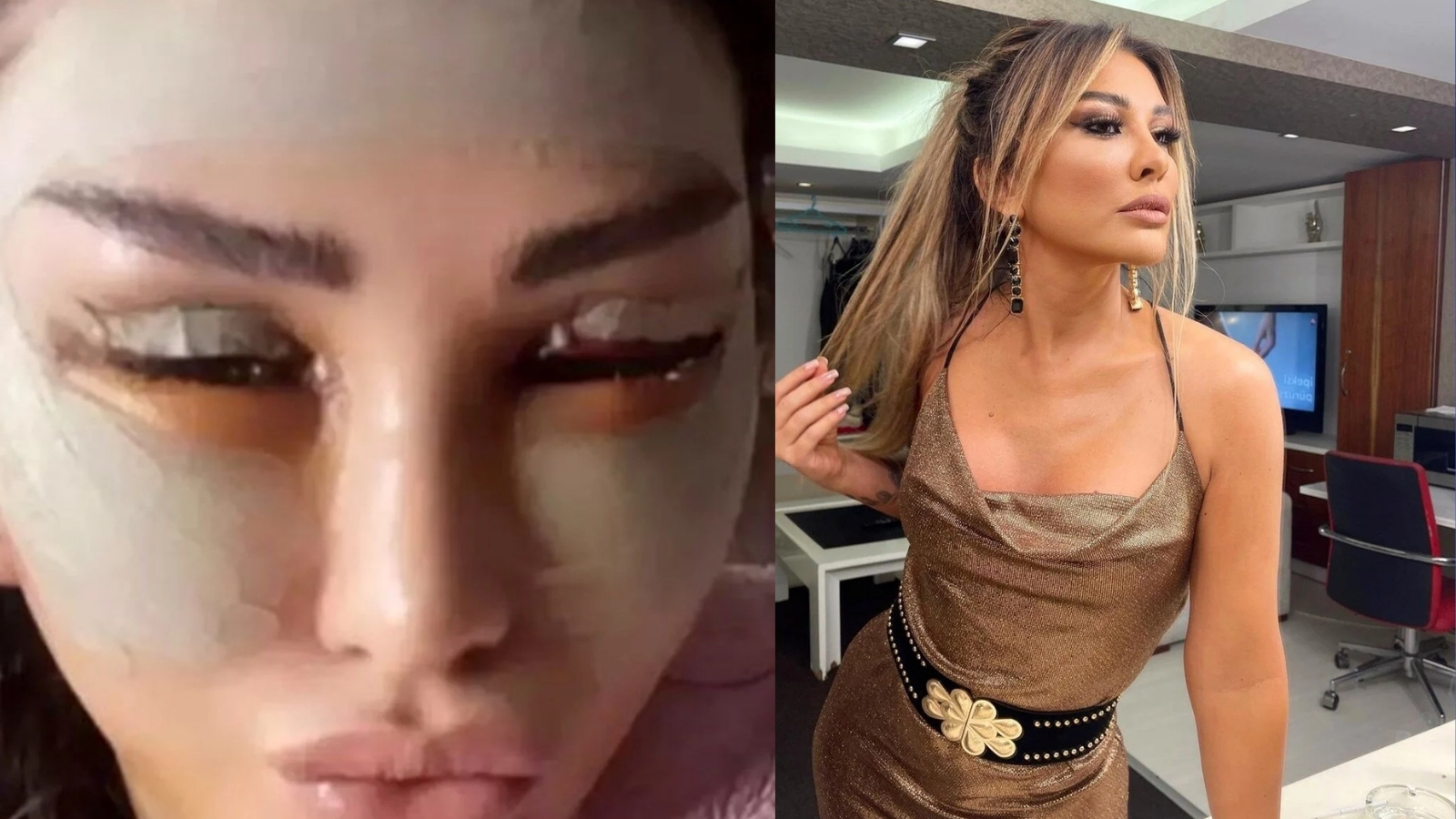 Selen Görgüzel Estetik Sonrasındaki Halini Paylaştı