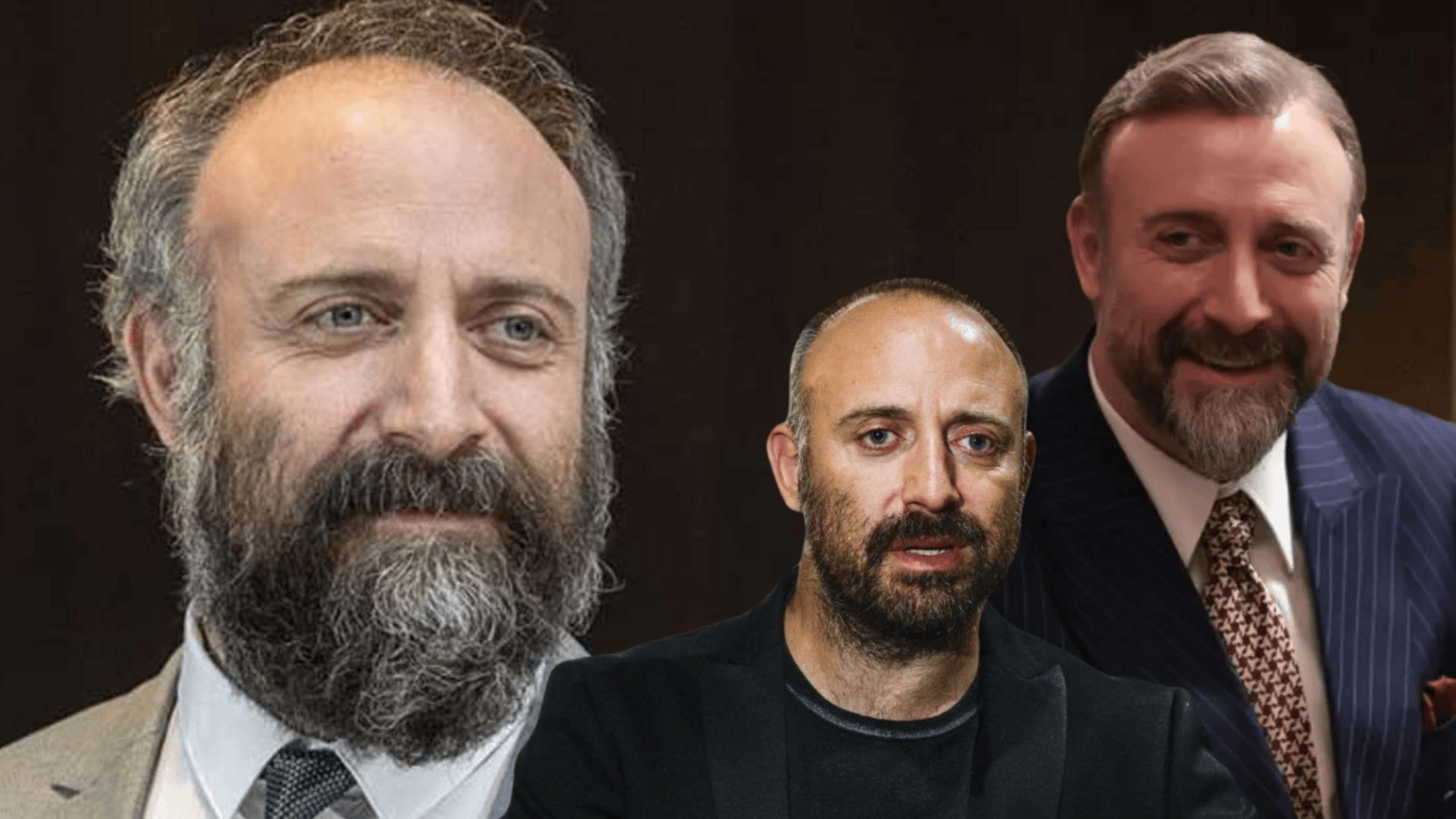 Halit Ergenç, saç mı ektirdi!