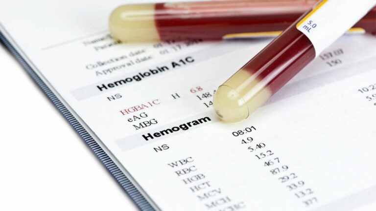 Kan Tahlili Sonucu Ne Zaman Çıkar?