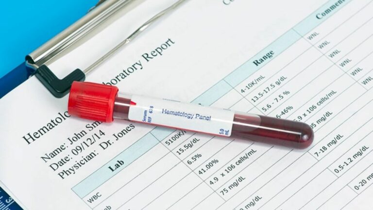 Kan Tahlili Sonucu Nasıl Yorumlanır?