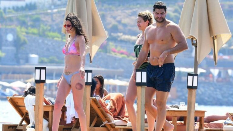 Müjde Uzman Bodrum Tatilinde Objektiflere Takıldı: Bacağındaki Morluk Dikkat Çekti