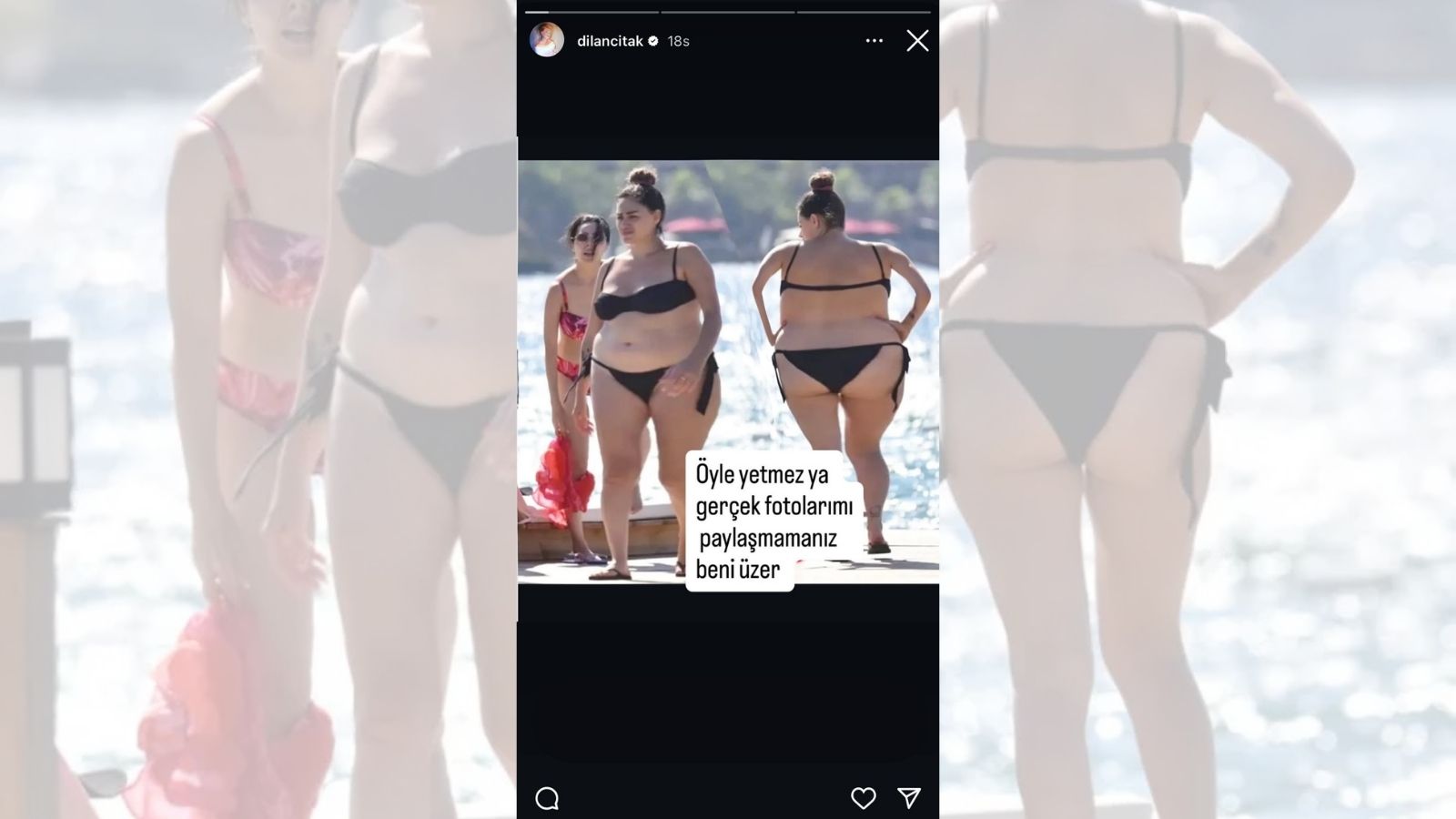 Dilan Çıtak, Shop Yaparak Tepki Gösterdi - Magazin Haberleri