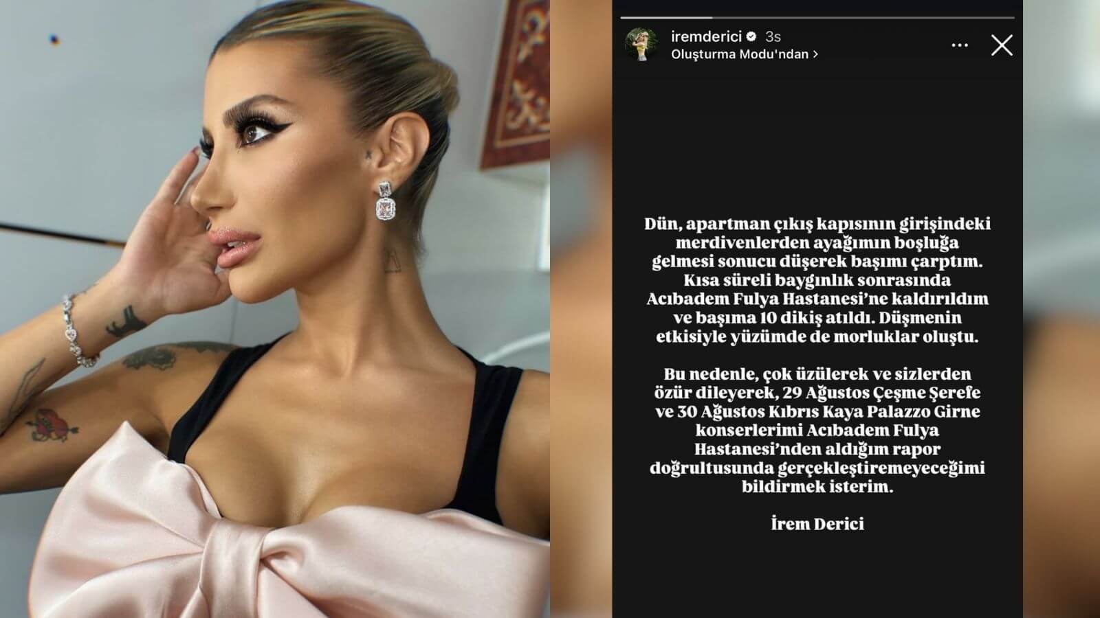 İrem Derici’nin Başına Talihsiz Kaza: Kafasına 10 Dikiş Atıldı, Konserler İptal