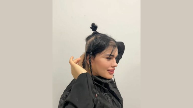 TikTok Fenomeni Hülya Mizgin’in Saçları Estetik Kurbanı!