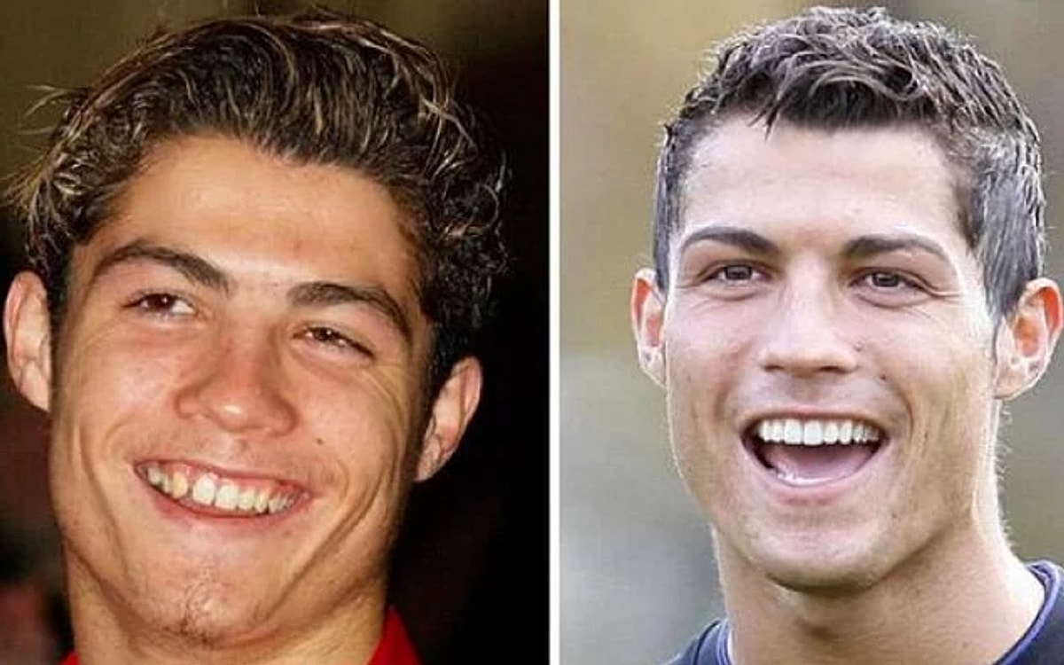 cristiano ronaldo estetiksiz hali