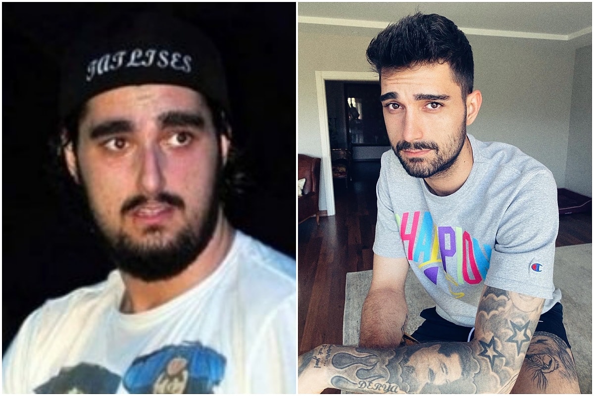 ido tatlıses estetiksiz hali