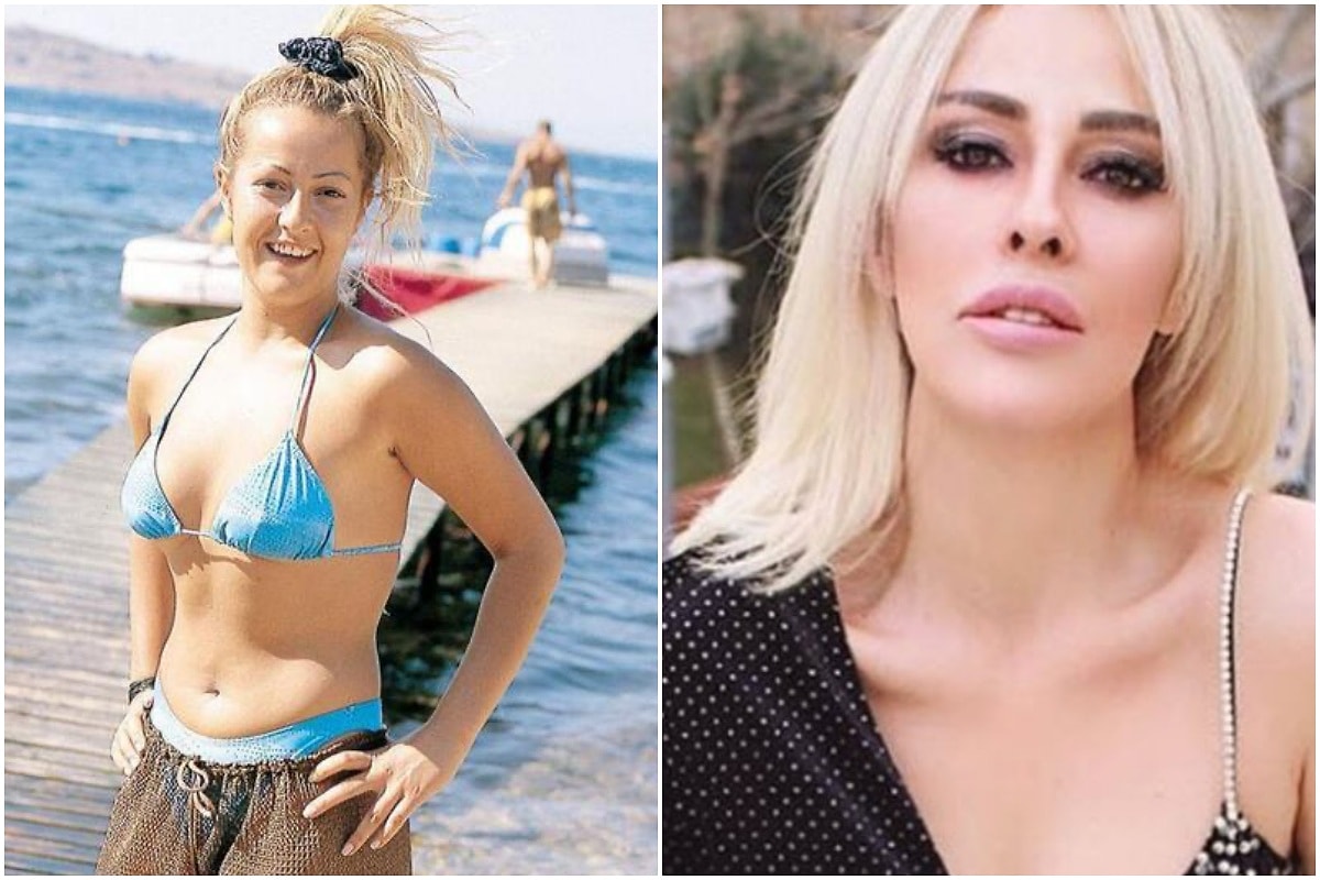 helin avşar estetiksiz hali