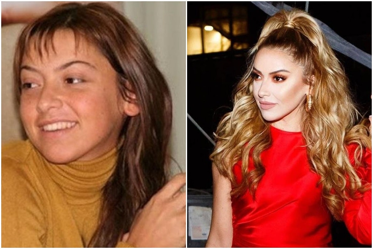 hadise estetiksiz hali