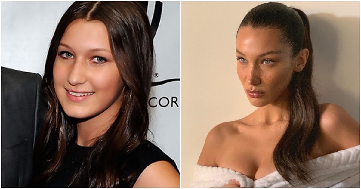 bella hadid estetiksiz hali
