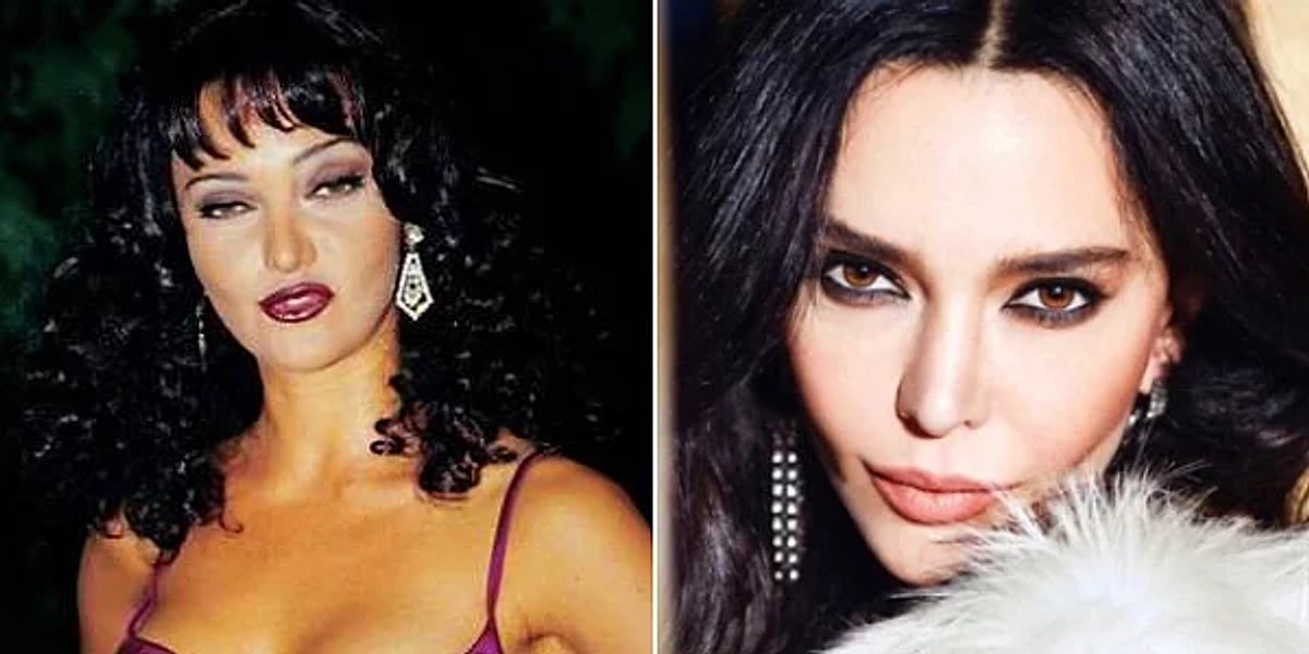 hande ataizi estetiksiz hali