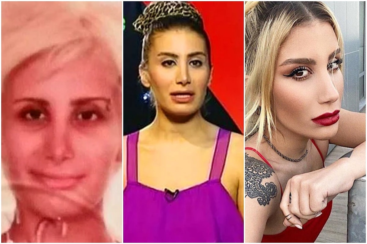 irem derici estetiksiz hali